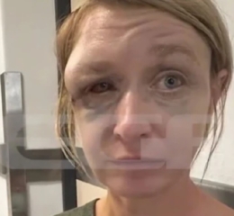 Κορωπί: «Δεν με έδειρε ο σύντροφός μου, δεν θυμάμαι πώς χτύπησα» &#8211; Τα πρώτα λόγια της Λιθουανής