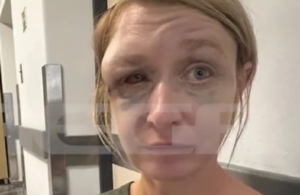 Κορωπί: «Δεν με έδειρε ο σύντροφός μου, δεν θυμάμαι πώς χτύπησα» &#8211; Τα πρώτα λόγια της Λιθουανής