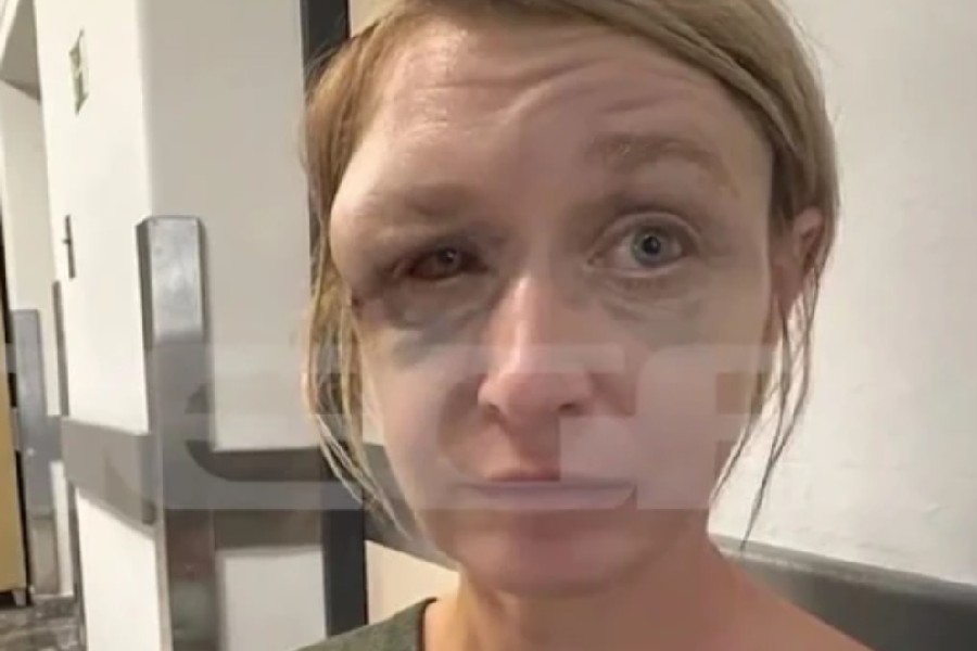 Κορωπί: «Δεν με έδειρε ο σύντροφός μου, δεν θυμάμαι πώς χτύπησα» – Τα πρώτα λόγια της Λιθουανής