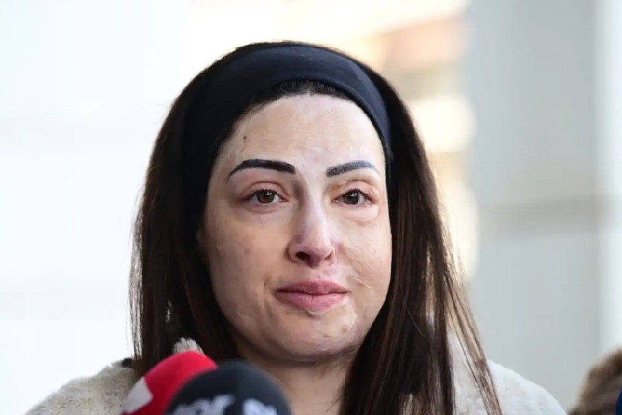 Ιωάννα Παλιοσπύρου για τυχόν αποφυλάκιση της γυναίκας που της έριξε βιτριόλι: Μου προκαλεί σοκ, είναι εγκληματίας